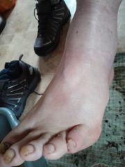 Best way to remove dead skin/keep feet smooth?