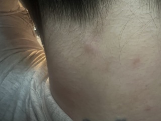 Relating to earlier post (lump on neck)