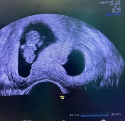Due February 2025 - Thread 2