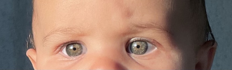 Eye colour
