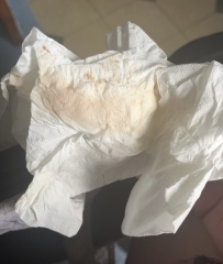 10dpo do I have line eyes?