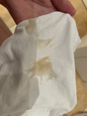 To go to A&E over this? (9 weeks, no EPU here)  *MNHQ ADDING CONTENT WARNING FOR PHOTO*