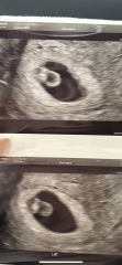 Early scan or no?