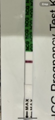 12 DPO - line eyes?