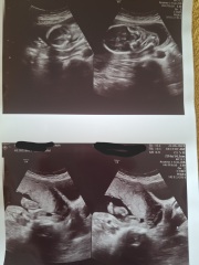Definitely a boy ???