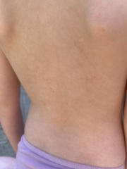 Could this rash be an autoimmune thing? Please help!