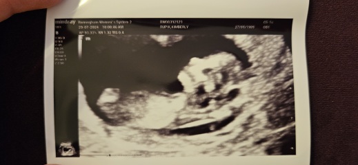12 week scan, boy or girl? (Just for fun!)
