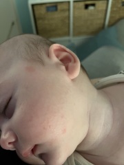 Aptamil pepti 1 - stick it out?