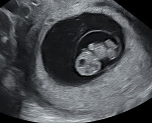 Due February 2025 - Thread 2