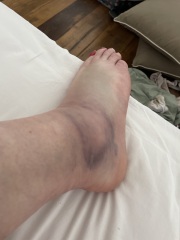 Any Dr’s about? What are the chances that this ISN’T broken?😞