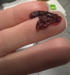is this a normal period clot??! Warning pictures included!