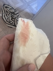 Pink Continuous Bleed 7 weeks Pregnant