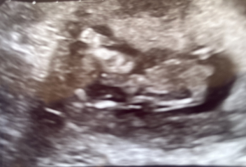 Guess the gender (just for fun)