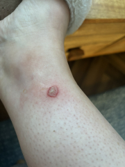 what is this that has appeared on my leg ?
