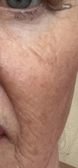 I'm confused, dermatica/skin & me