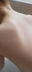 What is this on my toddler? Itchy?!