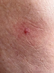 Funny looking mole type thing