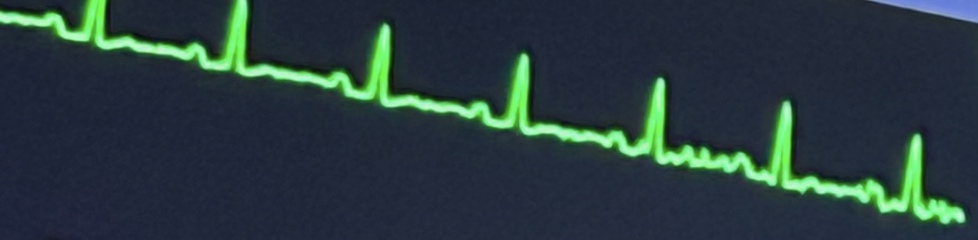 Ecg interpretation question 😀