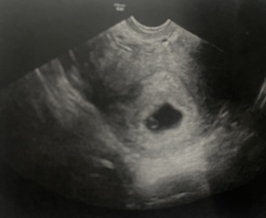 Ramzi theory scan photo