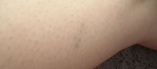 What is this??? - health