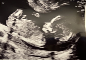 Boy or Girl 💙🩷