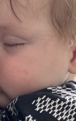 Guilt… Finger nail scratch toddler face