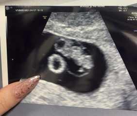 Early scan or no?