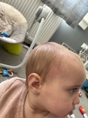 possible allergy?