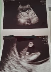 Definitely a boy ???