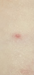 What are these spots?!