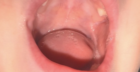 Teething toddler? Second molars? Experiences?!