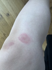 Bullseye bites?