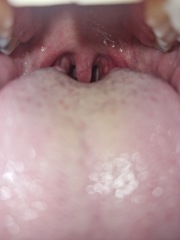 Back of throat