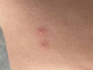 Chicken pic again?!!