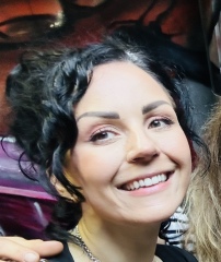 Gummy Smile Botox problem - pic included.