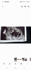 Gender guesses