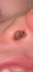 Dried snot in babies nose