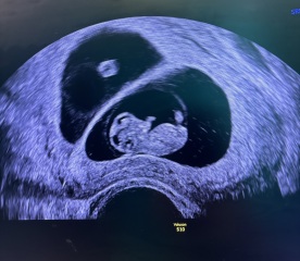 Due February 2025 - Thread 2