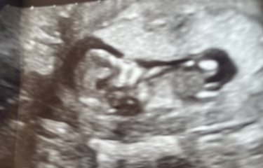 Boy or girl