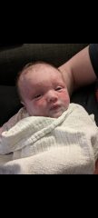 Little spots on babies face