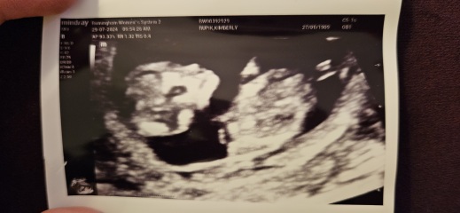 12 week scan, boy or girl? (Just for fun!)