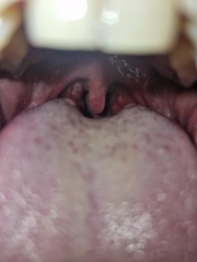 Back of throat