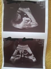 Definitely a boy ???