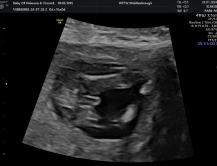 Is this really a boy?!