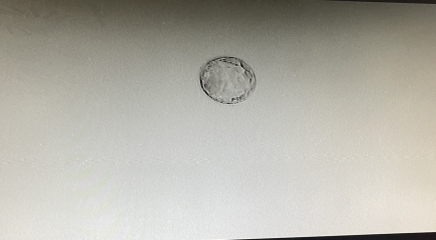 BFP after IVF - anyone want to join me in the wait for first scan?