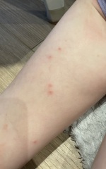 What are these spots?!