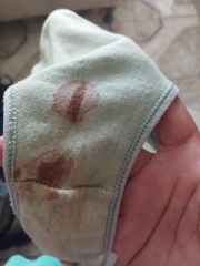 Is this implantation bleeding or just spotting?