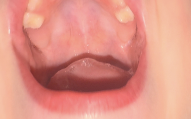 4.5y old twitchy at night