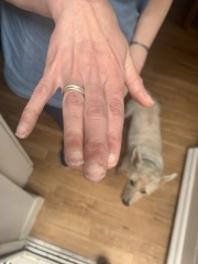 Possible broken index finger