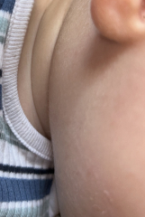 Fine hair on toddlers face?